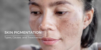 Skin Pigmentation: Causes, Types, and Treatments