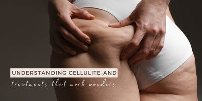 What Is Cellulite and How Can We Treat It?