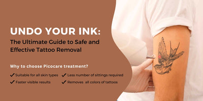 Get Rid of All Color of Tattoo's with Picocare Tattoo Removal